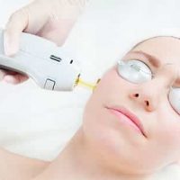 Photo - Laser at The Maple Leaf