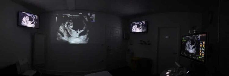 Photo - Babyvue
