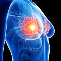 Photo - Phoenix Ultrasound