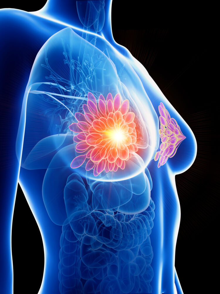 Photo - Phoenix Ultrasound