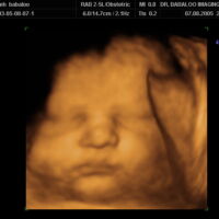 Photo - Phoenix Ultrasound