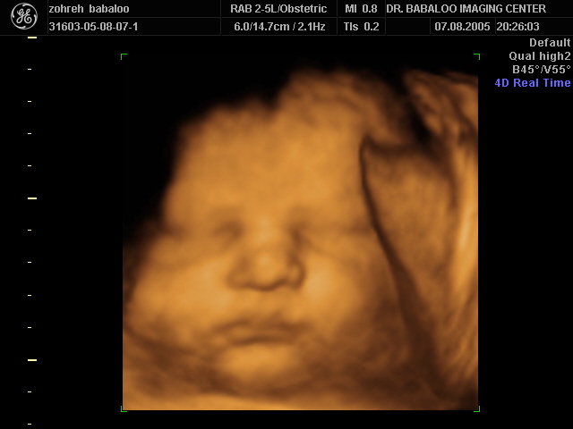 Photo - Phoenix Ultrasound