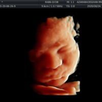 Photo - Phoenix Ultrasound