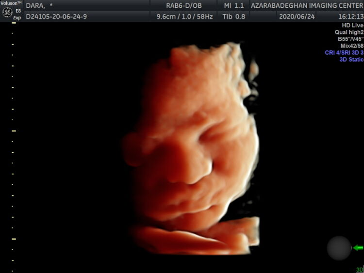 Photo - Phoenix Ultrasound