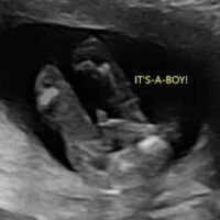 Photo - Babyvue