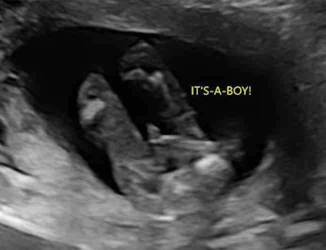 Photo - Babyvue
