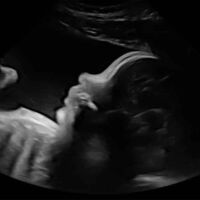 Photo - Babyvue