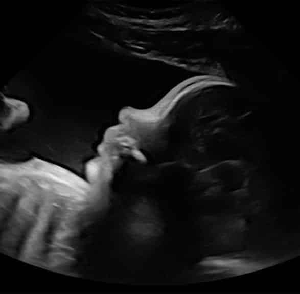 Photo - Babyvue