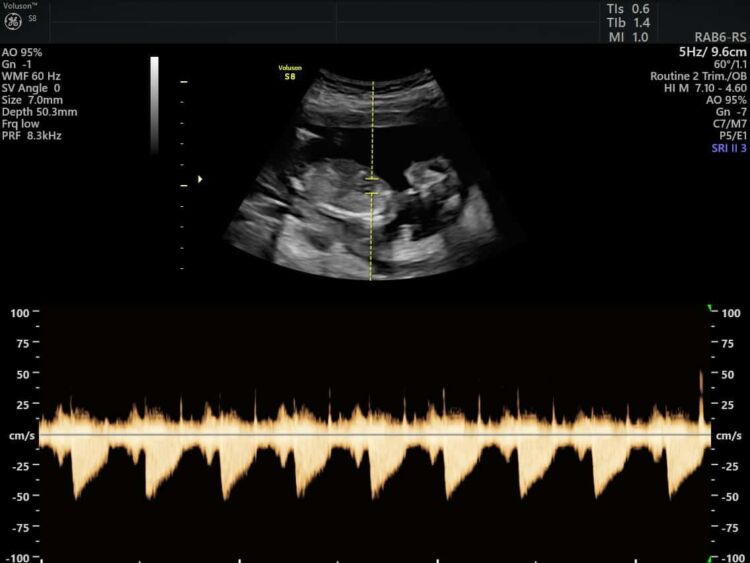 Photo - Babyvue