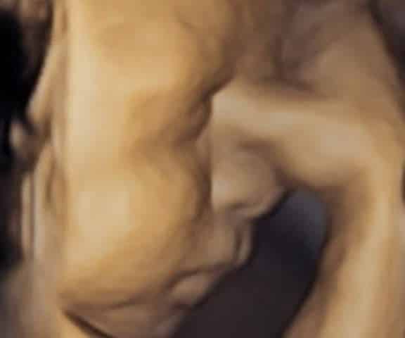 Photo - Babyvue